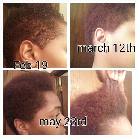 Wild Growth Hair Oil Results 3