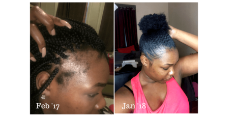 Wild Growth Hair Oil Results 4